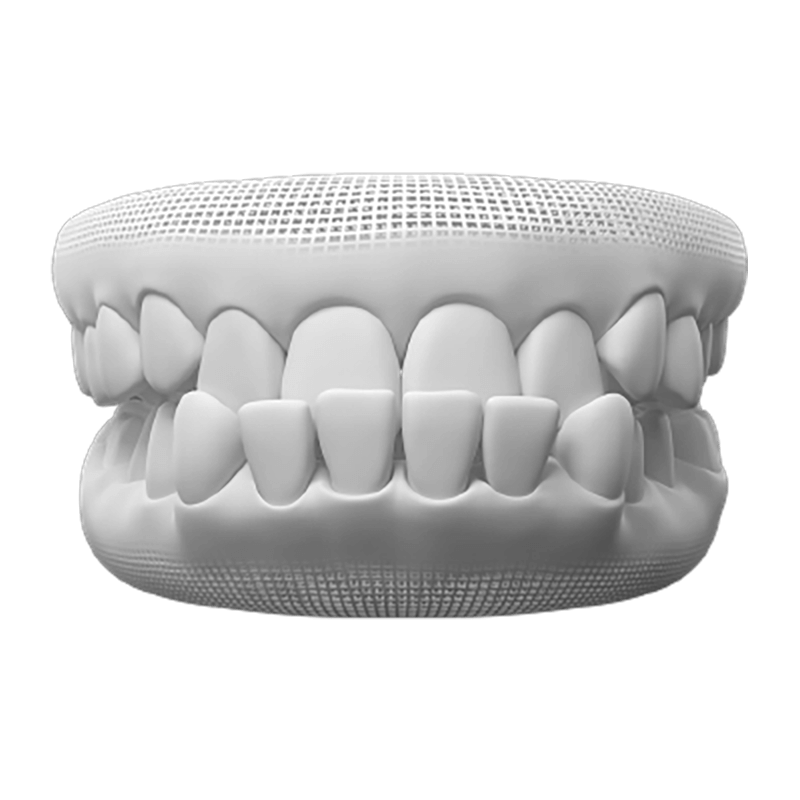 Underbite